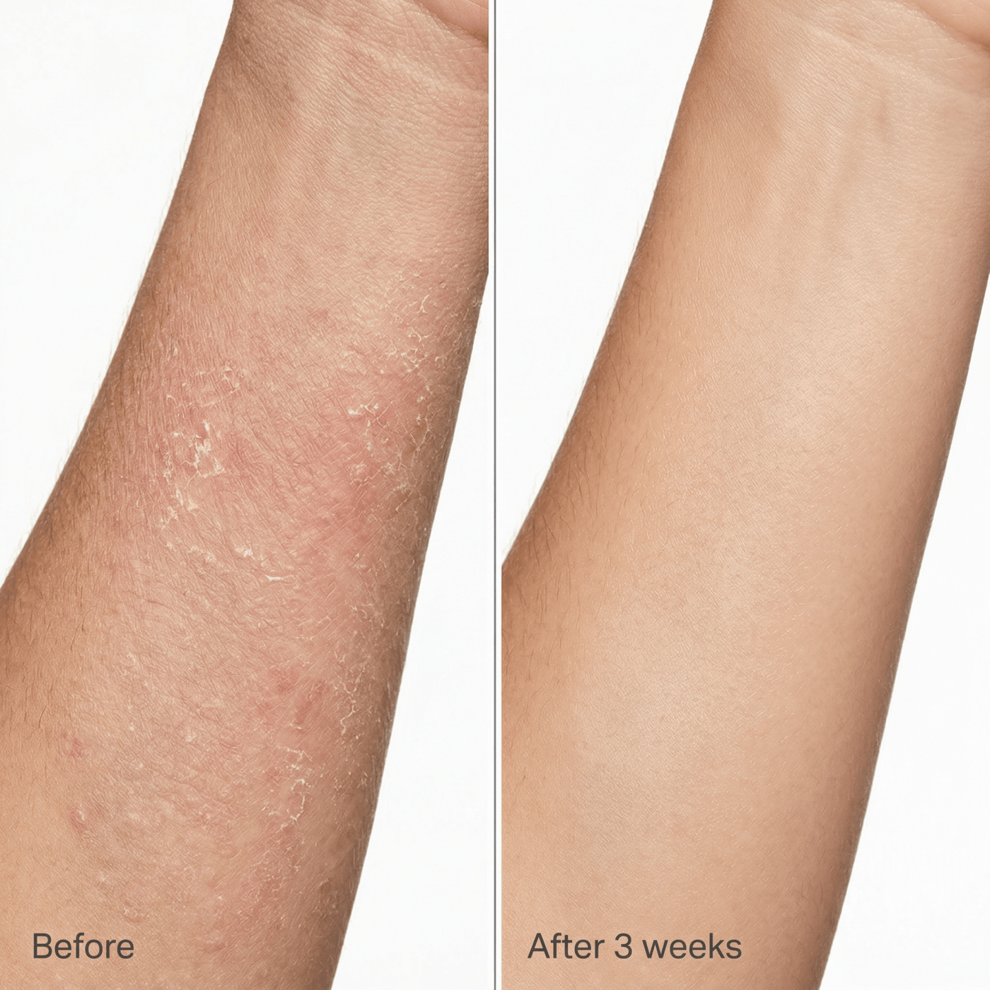 Skin before and after comparison